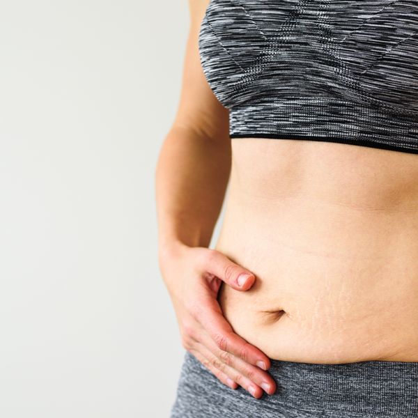 minilift-abdominal-chirurgie-esthetique-silhouette